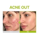 PURITO AZELAIC ACID 10 KOJIC TEA TEA SERUM 30ml