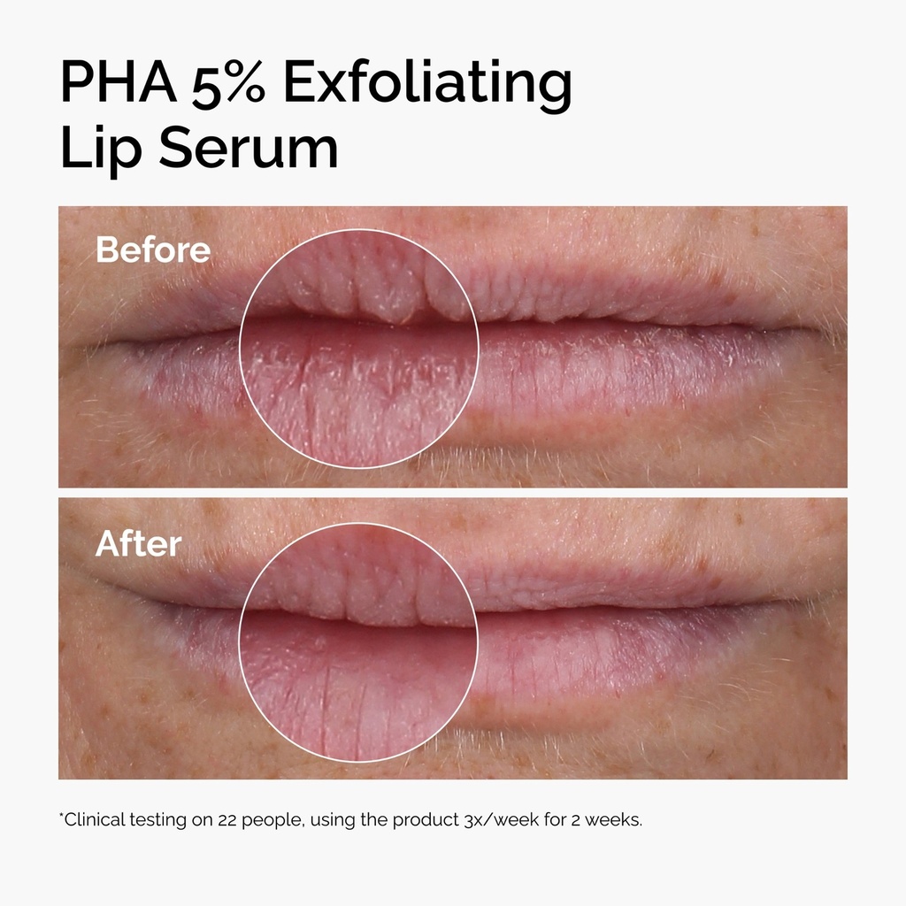 THE ORDINARY PHA 5% EXFOLIATING LIP SERUM
