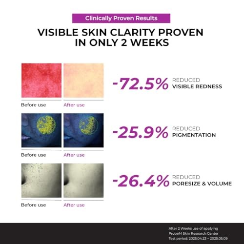 JUMISO NIACINAMIDE 10% SERUM 