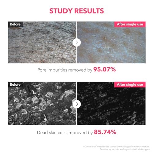 APRIL SKIN TXA NIACINAMIDE 99% DEEP CLEANSER