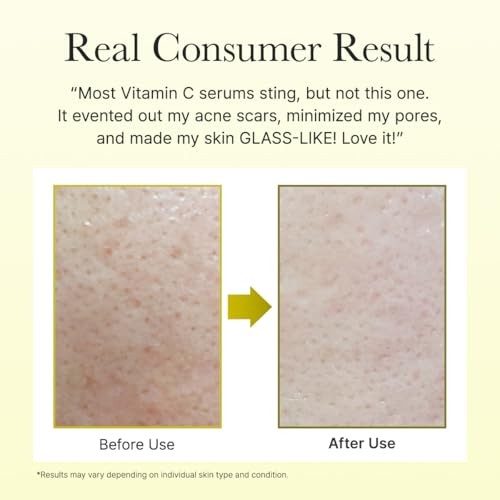 ARENCIA VIT C BOOSTER SHOT