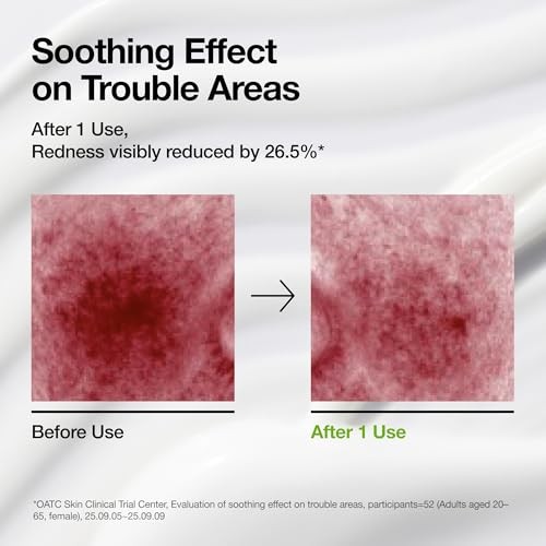 ANUA AZELAIC ACID CICA SOOTHING MOISTURIZER