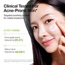 ANUA AZELAIC ACID CICA SOOTHING MOISTURIZER